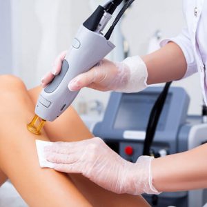 laser hair removal